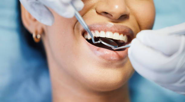Best Emergency Dental Care for Sports Injuries in Dixon, IL